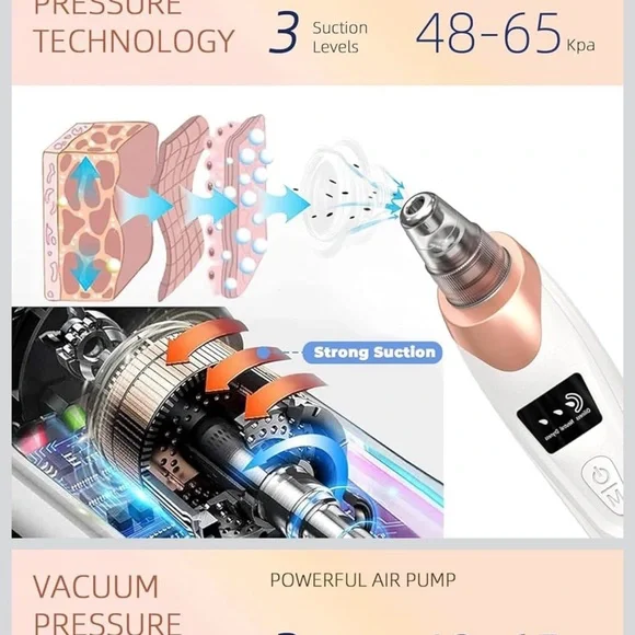 Electric Blackhead Remover Pore Vacuum - White & Rose Gold - Picture 6 of 7